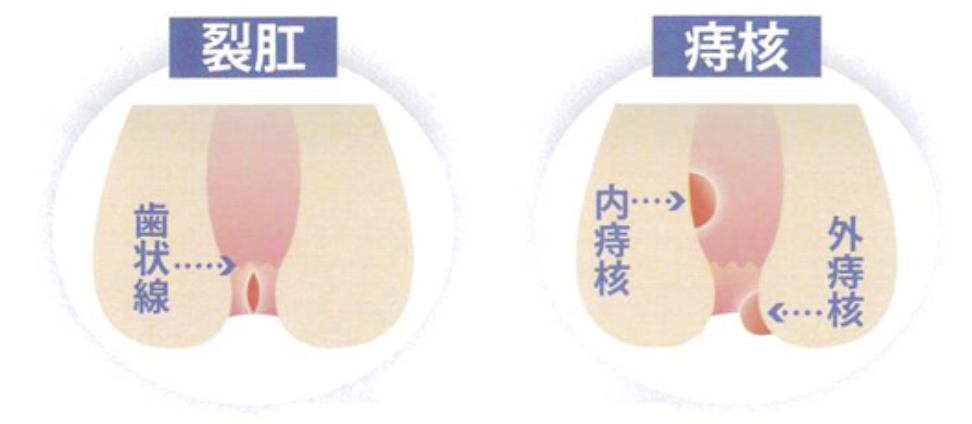 スクリーンショット (136)